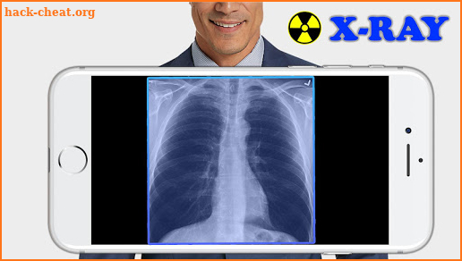 X-Ray Filter Photo screenshot