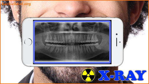 X-Ray Filter Photo screenshot