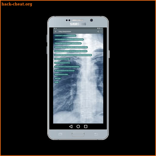X-ray Interpretation for Medical Use screenshot