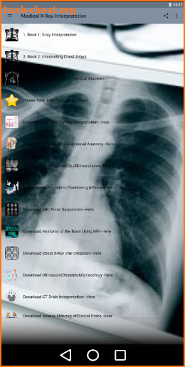 X-Ray -Medical XRay Interpretation with 100+ Cases screenshot