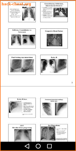 X-Ray -Medical XRay Interpretation with 100+ Cases screenshot