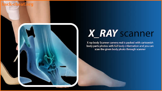 X ray scanner body real camera screenshot