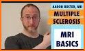 Understanding MRI: Multiple Sclerosis related image