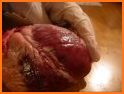 Heart Anatomy Pro. related image