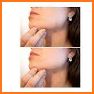 Touch To Erase - Photo Retouch Blemish Remove related image