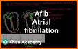 Atrial fibrillation related image