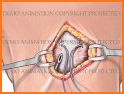 Nerve Block Star related image