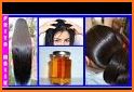 Hair Care - Dandruff, Hair Fall, Black Shiny Hair related image