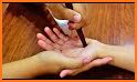AcuPoint - Acupuncture related image