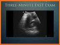 Fast Scan related image