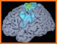 Brain Scan related image