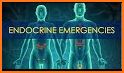 Endocrine Emergencies related image