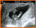 eCodadys My Baby 5D-4D related image