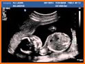 A-Z Obstetrics Ultrasound related image