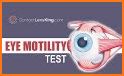 Ocular Motility Disorders, 4 related image