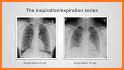 A-Z Chest X-Ray Interpretation related image