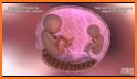 Pregnant Mommy And Twin Baby Care related image
