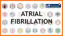 Atrial Fibrillation Risk - Stroke, TIA, Embolism related image