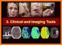Neuro Imaging related image