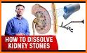 Kidney Stones Home Remedies related image