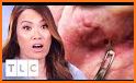 Dr. Pimple Popper related image