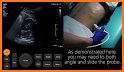 Urological Ultrasound related image