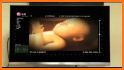 Ultrasound Spoof Prank related image