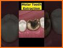 Dentist Tooth Repair Games related image