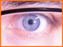 Eye Anatomy Pro. related image