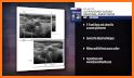 Atlas of Ultrasound Anesthesia related image