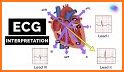 ECG Interpretation: Pkt Guide related image
