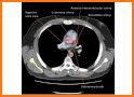 Atlas of CT Anatomy related image