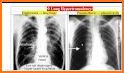 Chest X-Ray And Pathology related image