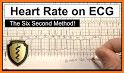 Heart Rate related image