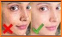 Face Blemishes Removal related image