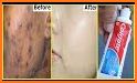 Face Blemishes Remover & Photo Scars Remover related image