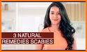Scabies Natural & Home Remedies related image