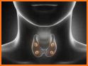 Hyperparathyroidism Info related image