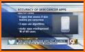 Skin Cancer App - MySkinPal related image