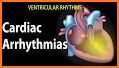 Cardiac diagnosis (heart rate, arrhythmia) related image