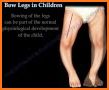Bendy Legs related image