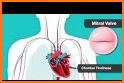 Auscultation - Heart, Lung Sounds, Cardiac Murmurs related image