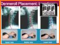 Denneroll Spinal Orthodics related image