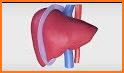 Liver Transplant Education related image