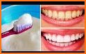 Whiten Teeth Naturally related image