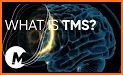 TMS related image