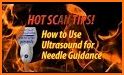 ACEP Critical Ultrasound Guide related image