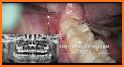 Dentist kids Hospital Simulation Teeth Surgery related image