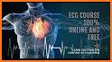 InVivo: ECG Course related image