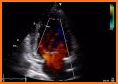 ECHOCARDIOGRAPHY GUIDE related image